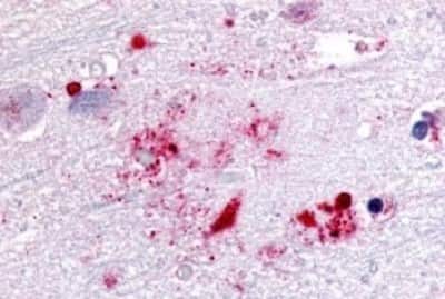 Immunohistochemistry: GPR119 Antibody [NBP3-14344]